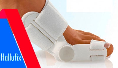 Новая терапевтическая концепция при вальгусной деформации пальца стопы